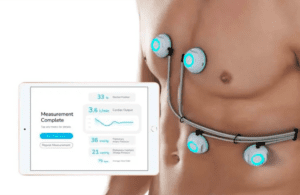 Sensydia marketing image of the biosensor array in its AI-powered Cardiac Performance System (CPS)