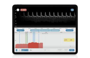 flosonics flopatch app